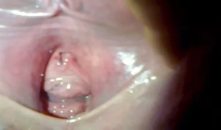 Cseh tizenéves családi sex video Pisilő arc